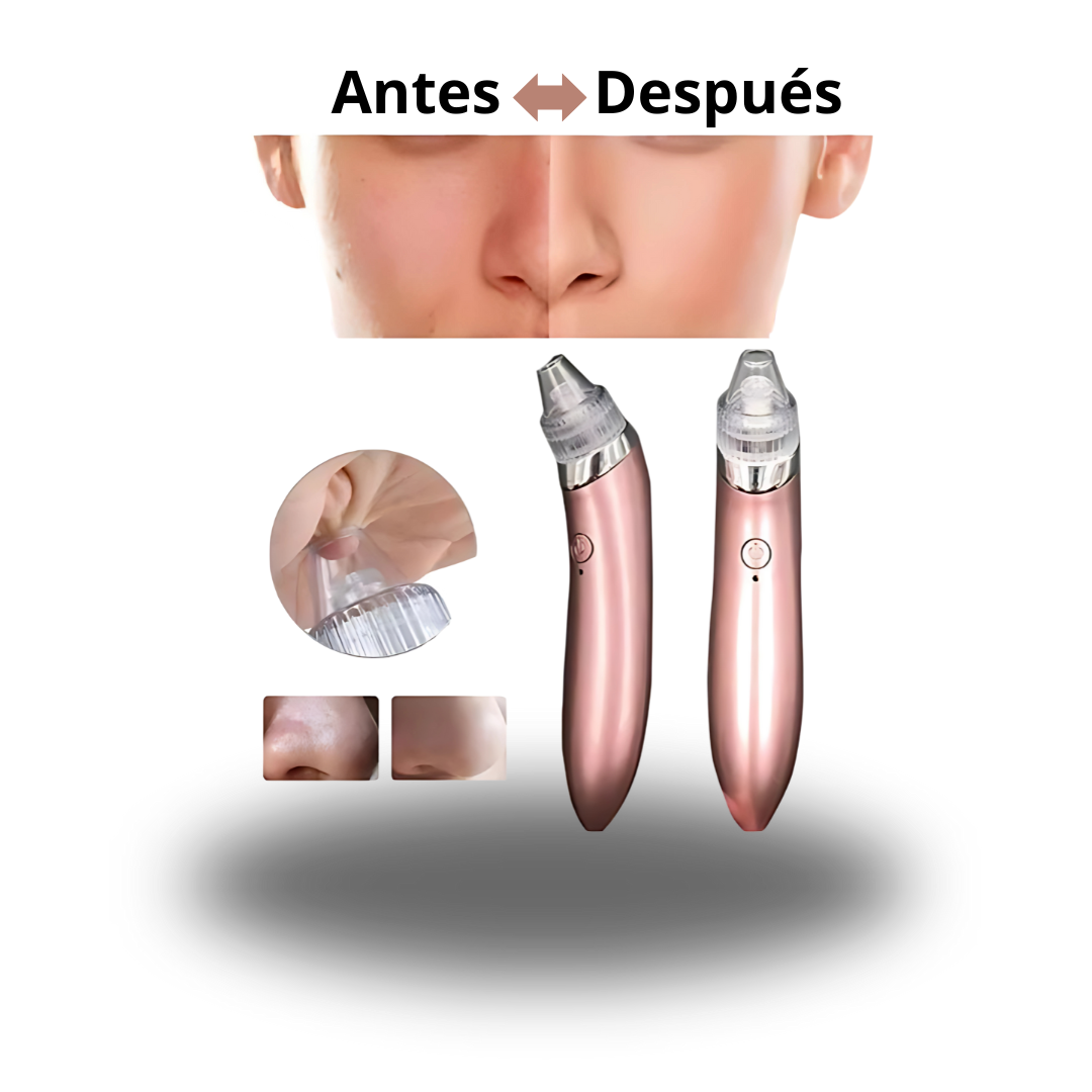 Extractor De Puntos Negros Y Espinillas